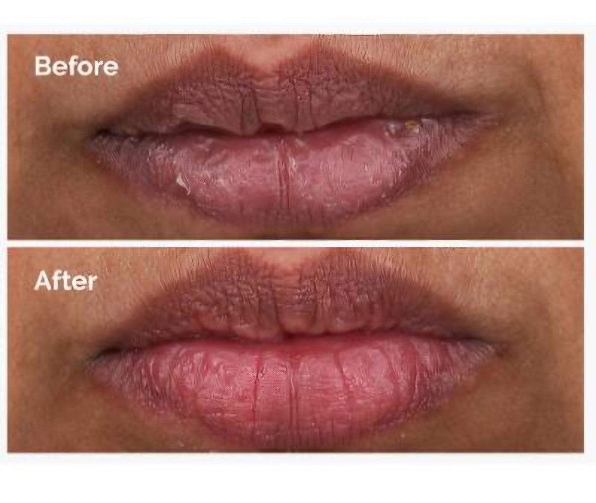 The Ordinary
PHA 5% Exfoliating Lip Serum- 15ml