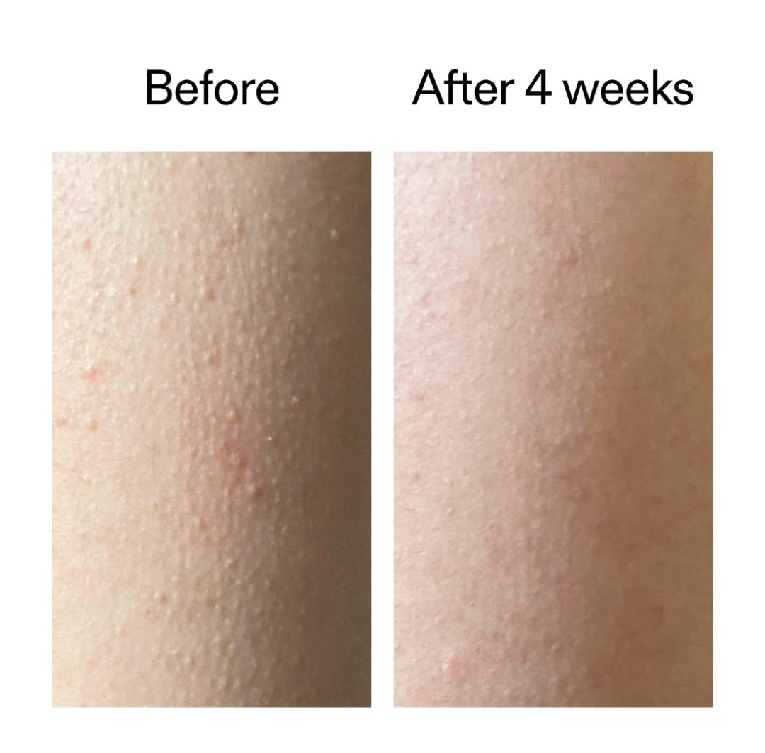 The INKEY List
Glycolic Acid Exfoliating Body Stick, 1.5 oz