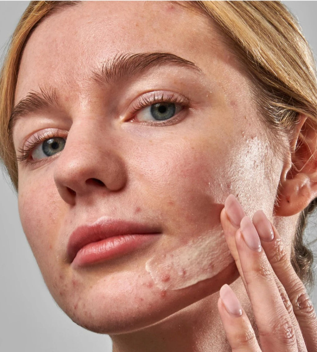 The INKEY List
SuperSolutions Acne Clearing Moisturizer 2% NOVORETINᵀᴹ