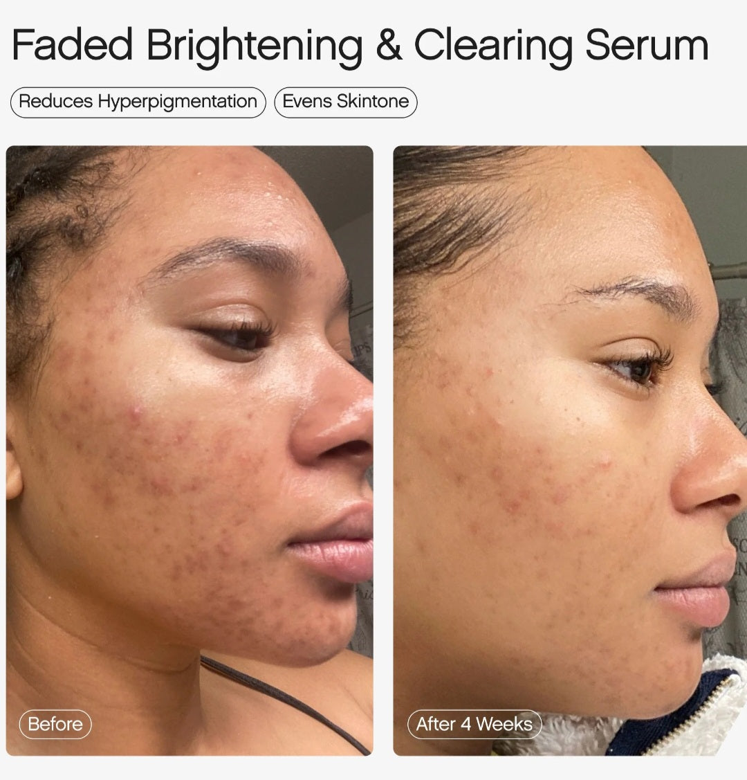 Topicals
Faded Serum for Dark Spots & Discoloration