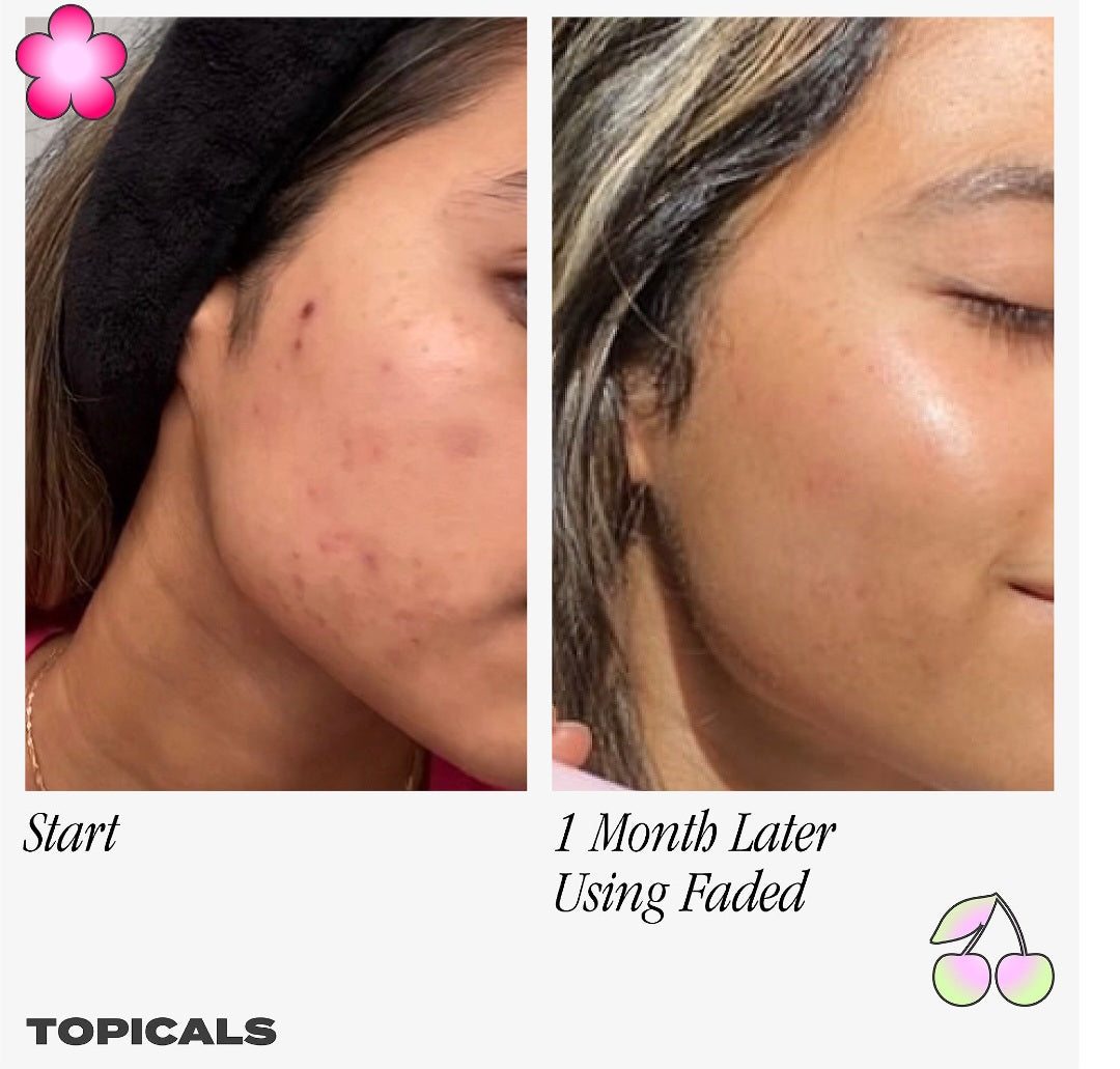 Topicals
Faded Serum for Dark Spots & Discoloration