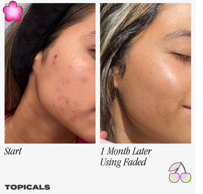 Topicals
Faded Serum for Dark Spots & Discoloration