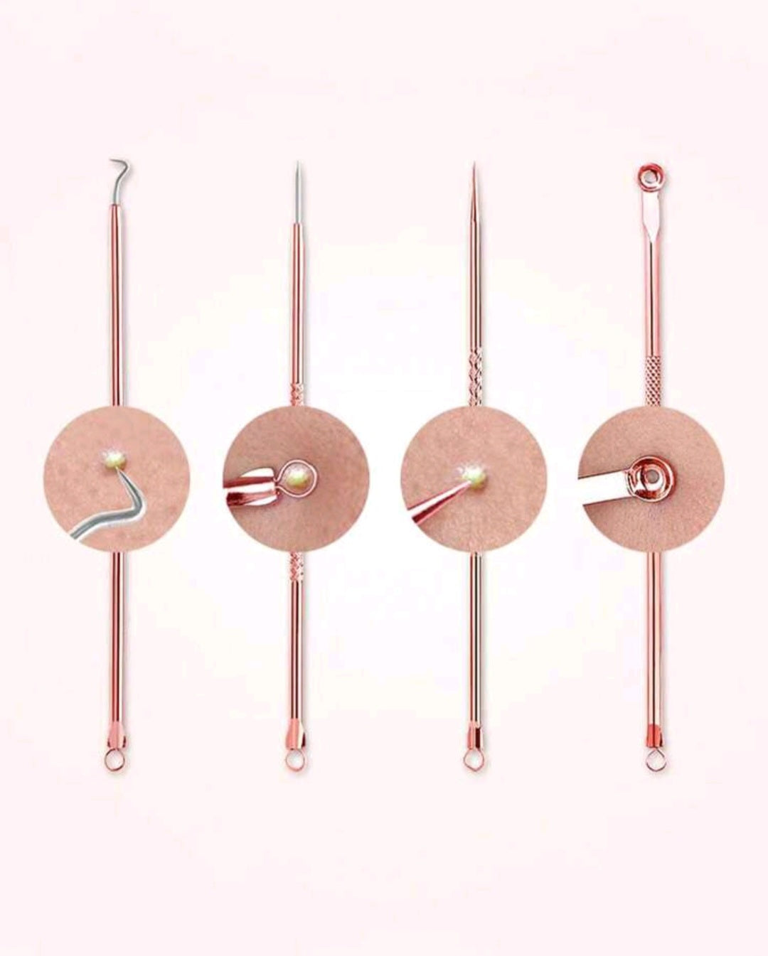 4 Piece Pimple Remover Tool Set