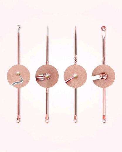 4 Piece Pimple Remover Tool Set