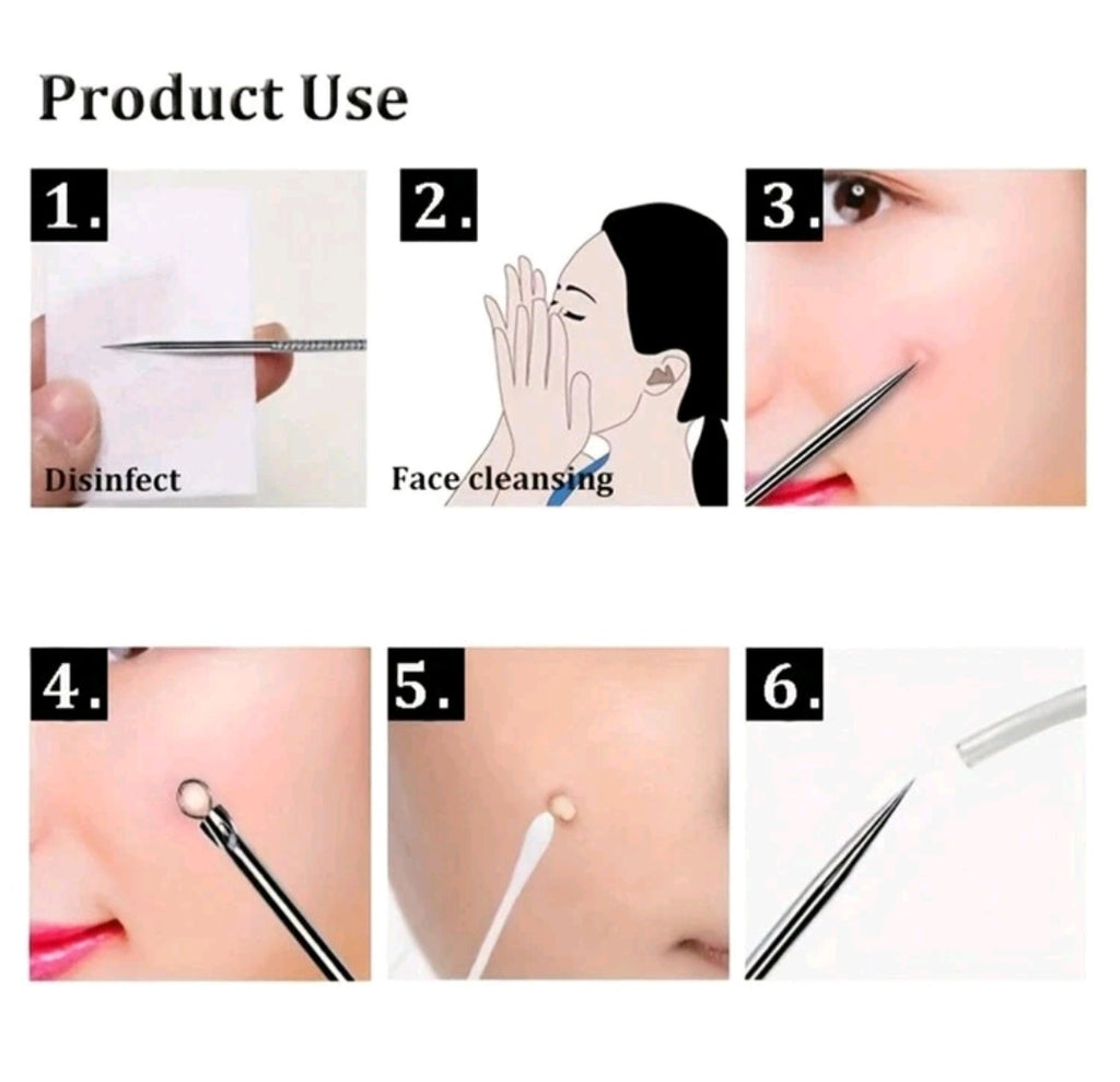 4 Pcs Acne - Pimple Remover Tool Set