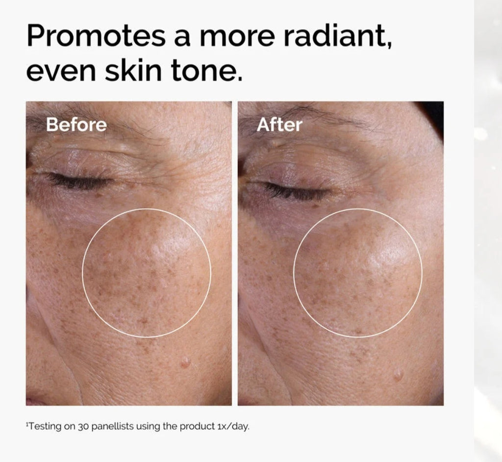 The Ordinary Glycolic Acid 7% Exfoliating Toner