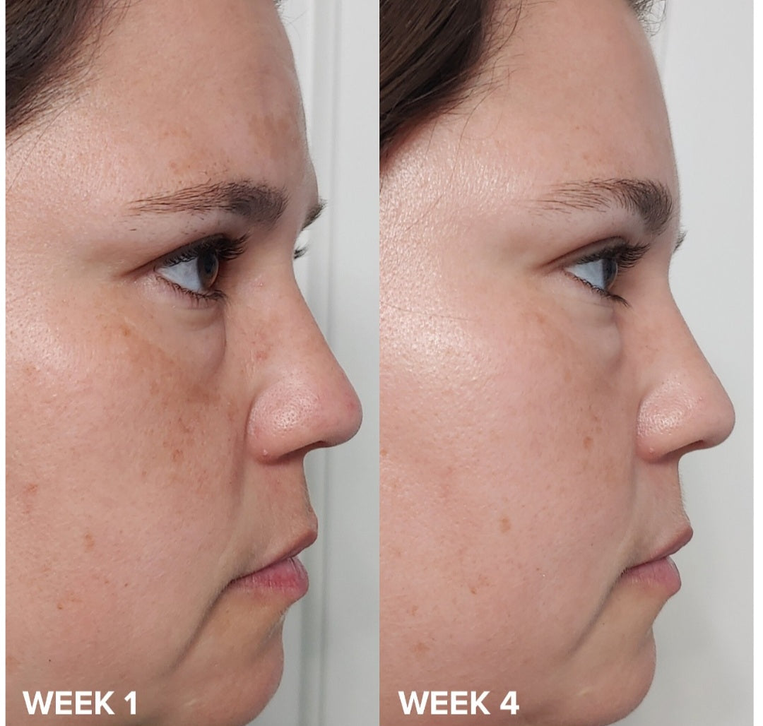 Paula's Choice Skin Perfecting 2% BHA Liquid Exfoliant