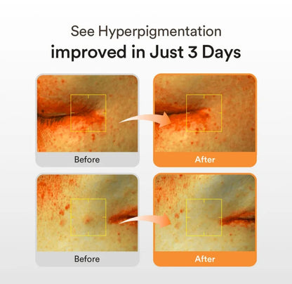 Abib - Glutathiosome Dark Spot Serum Vita Drop