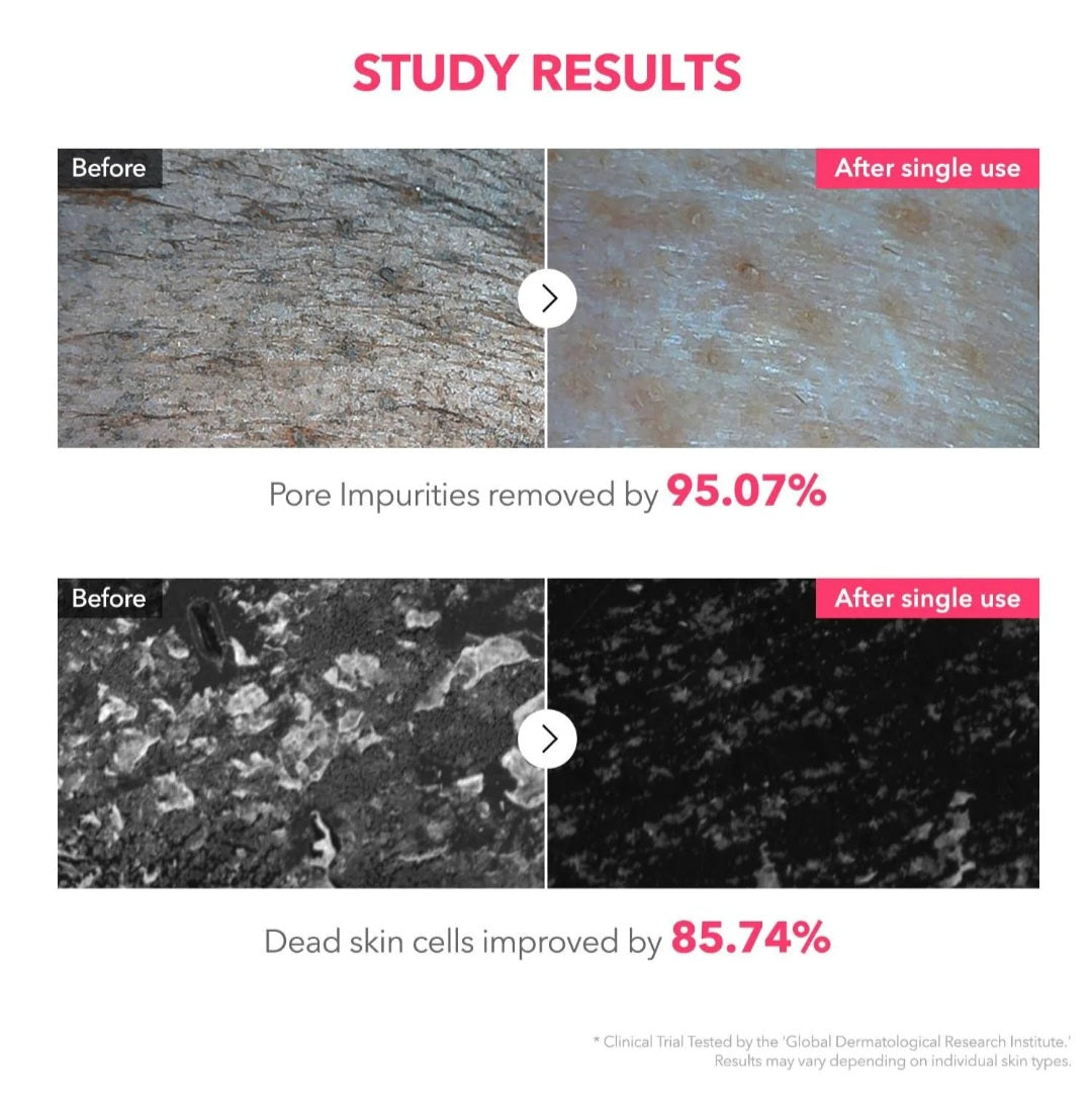 APRILSKIN - TXA Niacinamide 99 Deep Cleanser 4.23 oz (120 g)