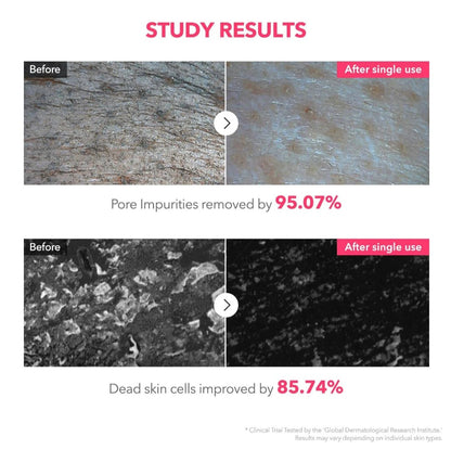 APRILSKIN - TXA Niacinamide 99 Deep Cleanser 4.23 oz (120 g)