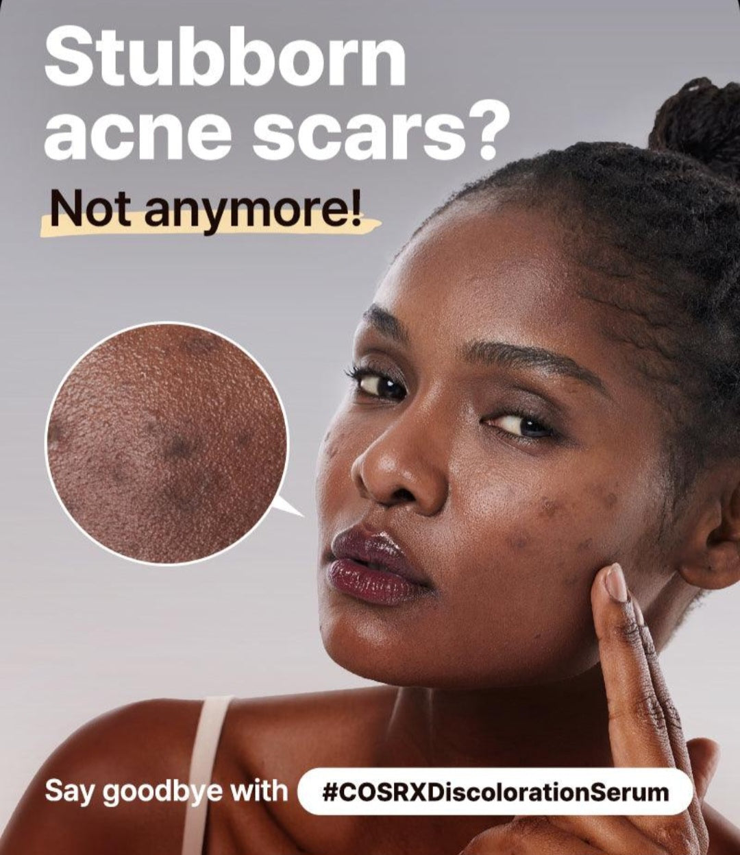 Cosrx The Alpha-Arbutin 2 Discoloration Care Serum