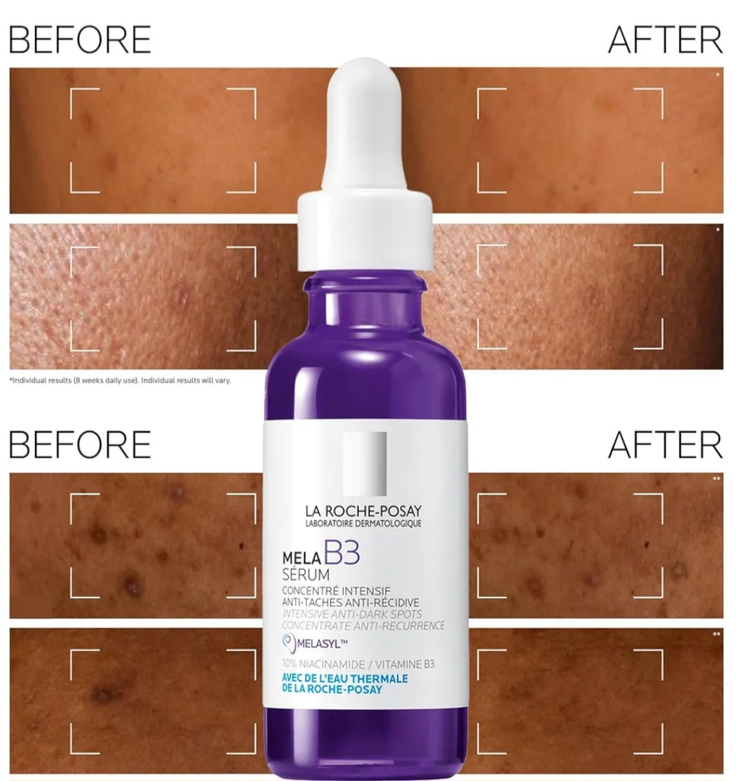 La Roche-Posay Mela B3 Intense Anti-dark spot serum