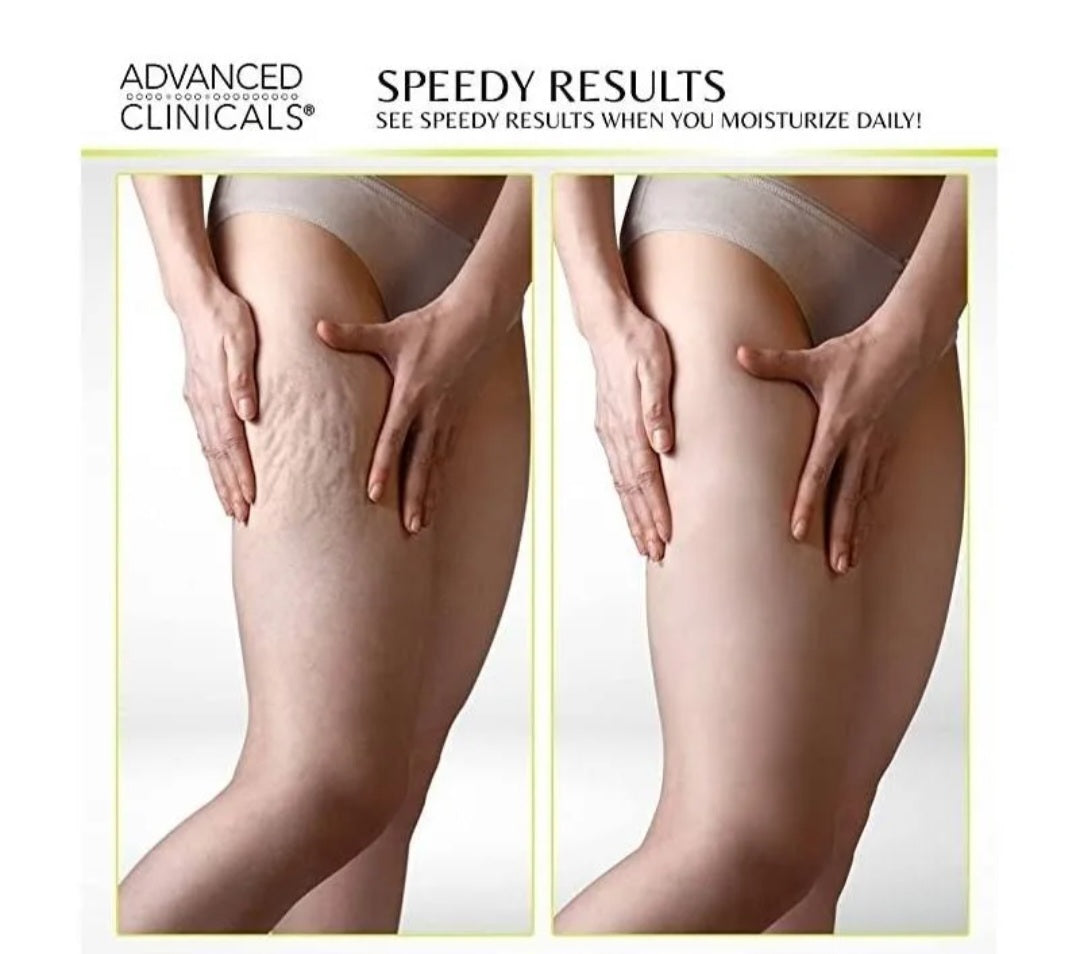 Advanced Clinical's Green Coffee Bean Oil Body Cream