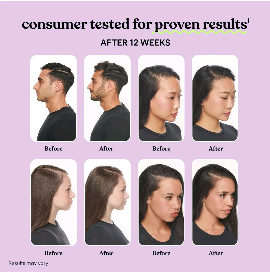 Lemme Grow Hair Growth & Anti-Shedding, 60 Caps