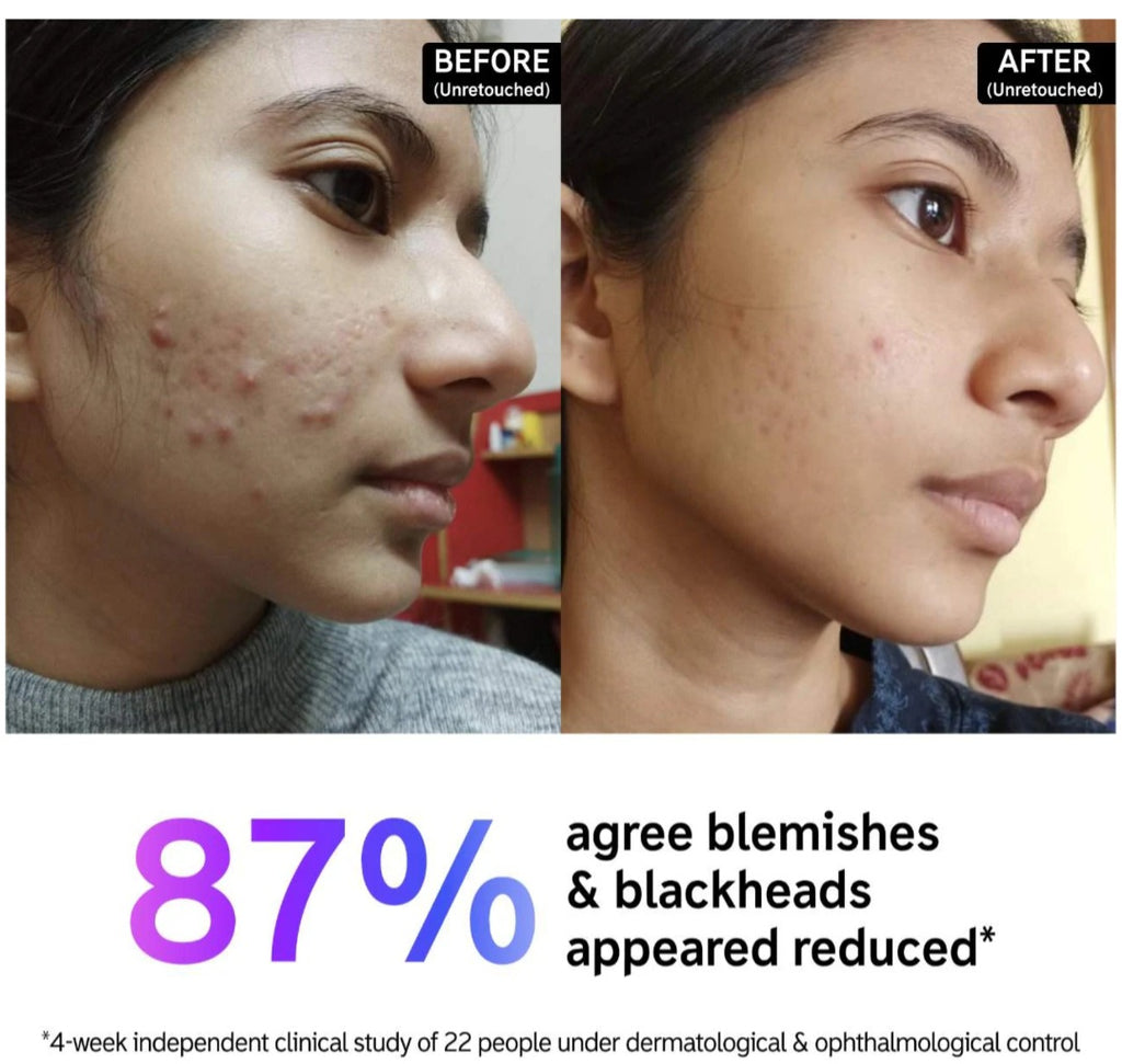 The INKEY List Salicylic Acid Acne + Pore Cleanser
