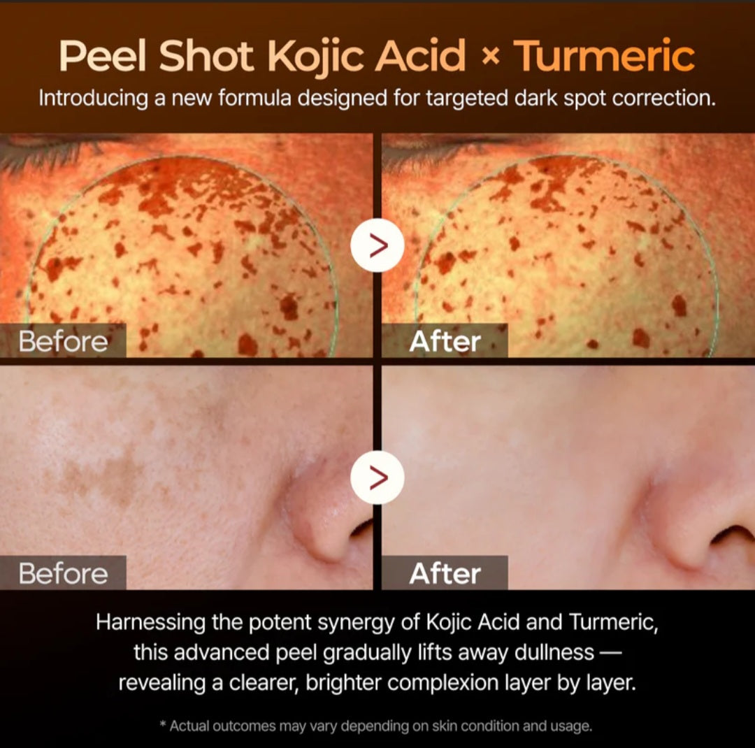 Dr.Melaxin Peel Shot Kojic Acid Turmeric Serum, all Skin Types, 80ml