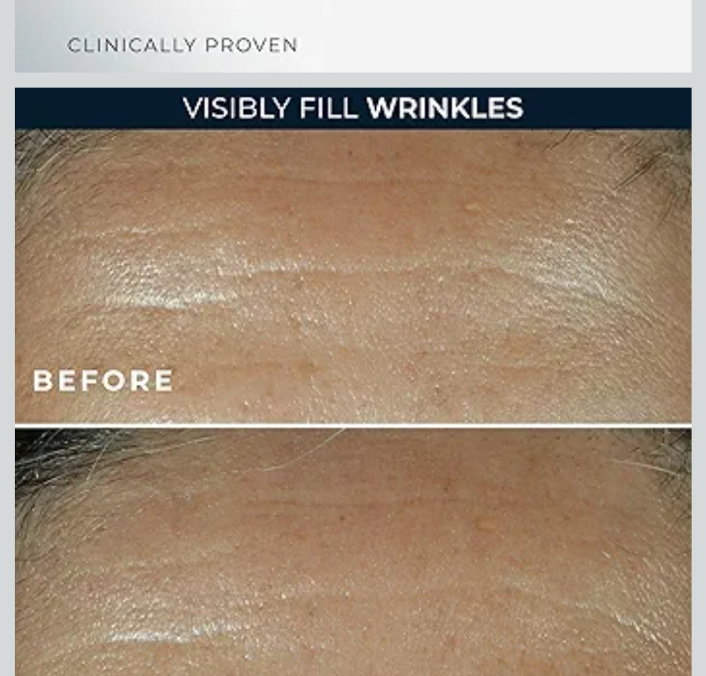RoC Retinol Correxion Wrinkle Filler for Deep Wrinkles