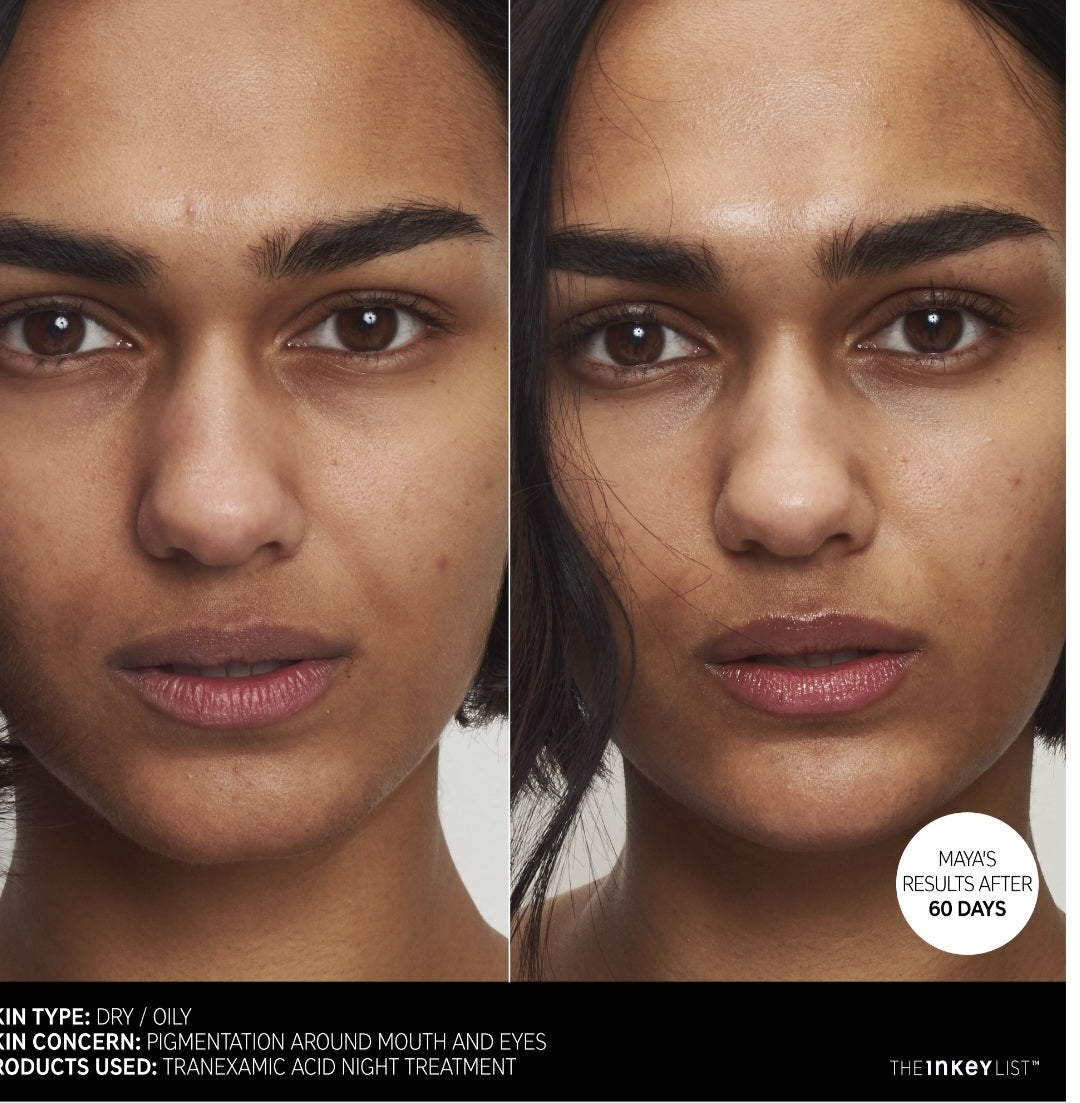 The Inkey List, Tranexamic Acid Hyperpigmentation Treatment