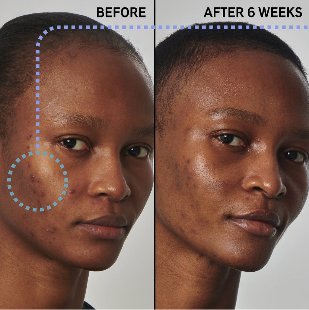 The INKEY List, SuperSolutions 20% Niacinamide Serum. 30 ML