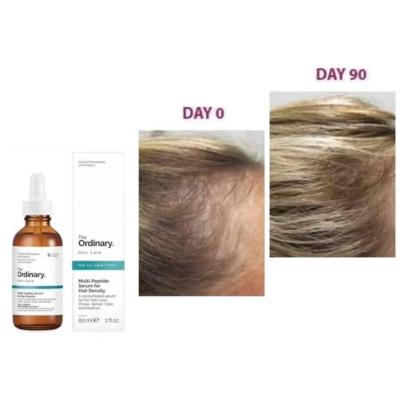 The Ordinary Multi - Peptide Serum For Hair Density ( 60ml )